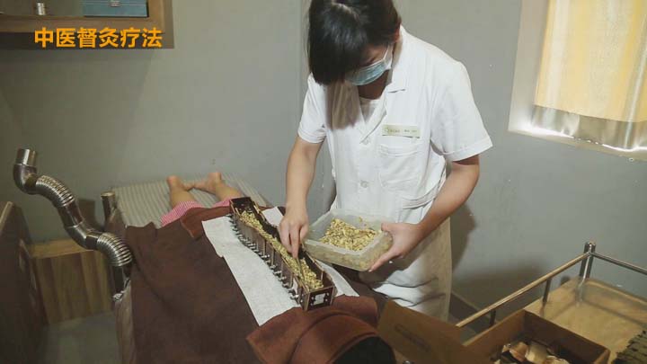 中醫督灸療法
